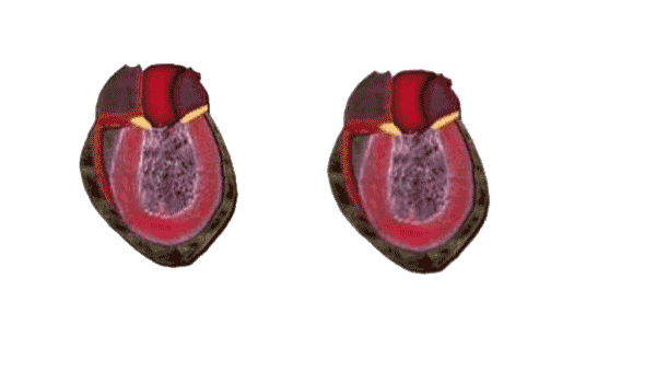 gesundes_herz Blutvolumenregulation